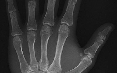 Should I save my medical images?