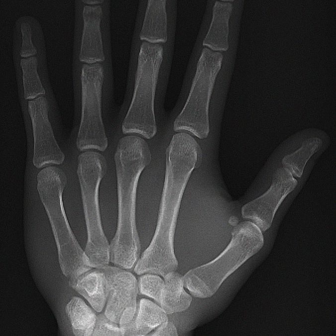 Should I save my medical images?