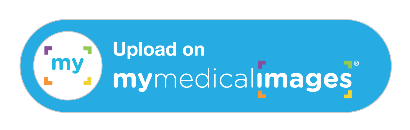 uploaderbutton-r-2025-01